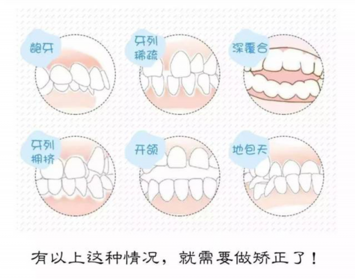 假牙套和真牙咬东西有什么区别,这些你应该知道！